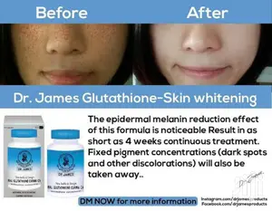 Dr James Skin Whitening Natural Glutathione Lightening Pills