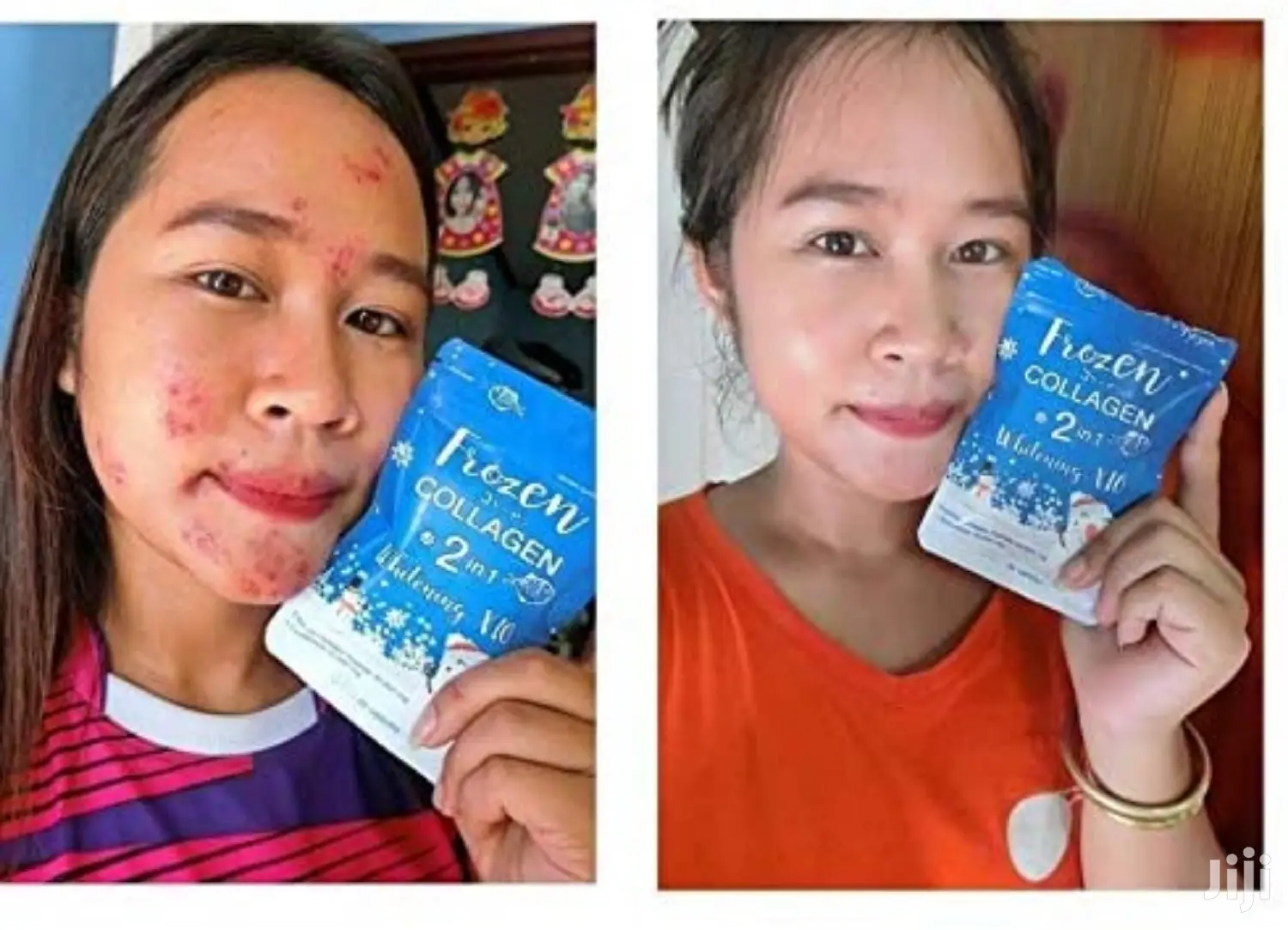ORIGINAL Frozen Collagen + Gluta X10 Skin WHITENING Tabs