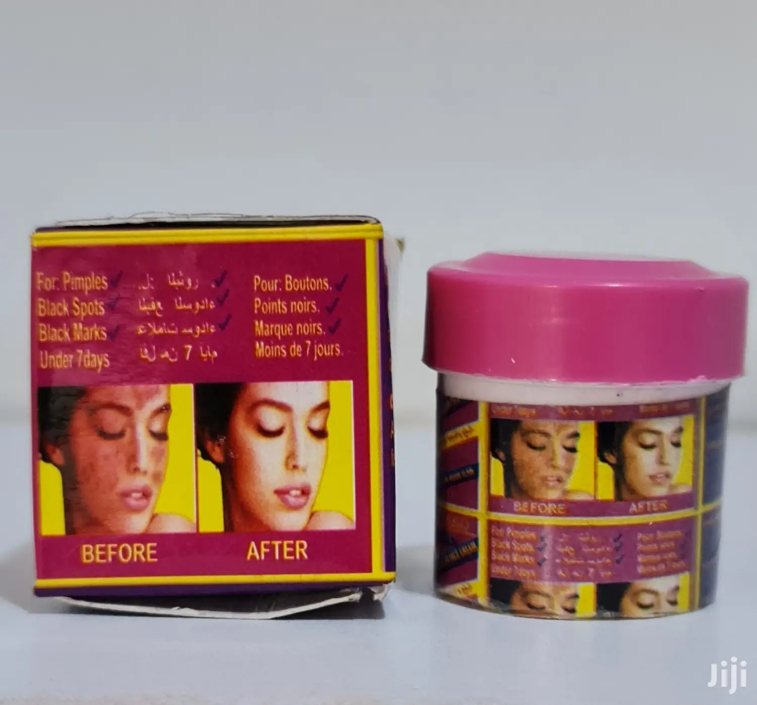 P.N.L Acne and Black Spots Clear Face Cream Cure for Pimples