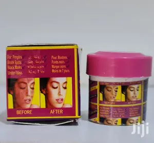 P.N.L Acne and Black Spots Clear Face Cream Cure for Pimples