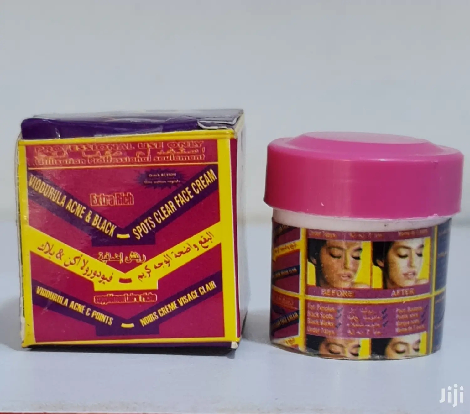 P.N.L Acne and Black Spots Clear Face Cream Cure for Pimples