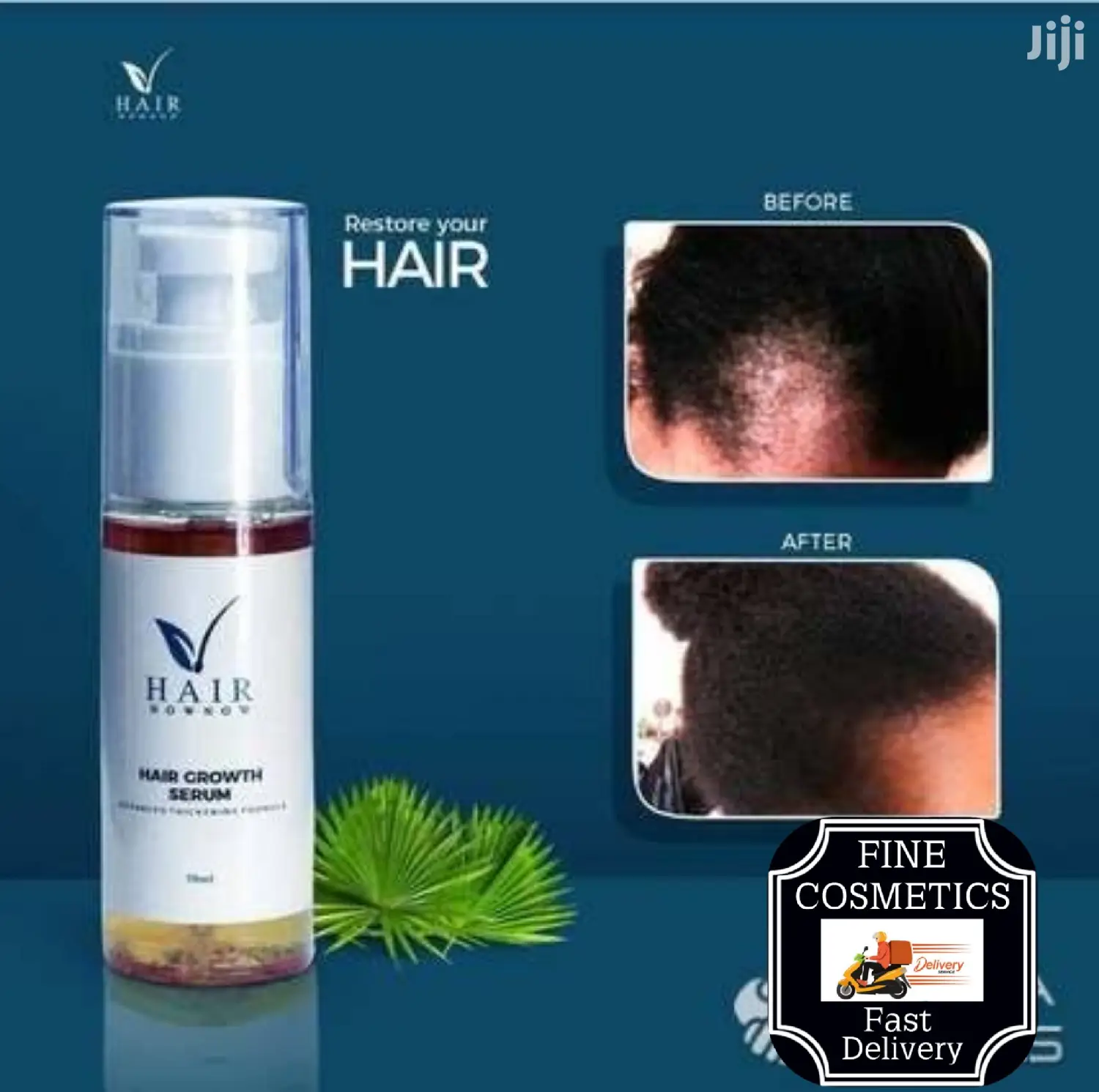 Hair Now Now | Hair Growth Booster Hairline Stimulating Oil.
