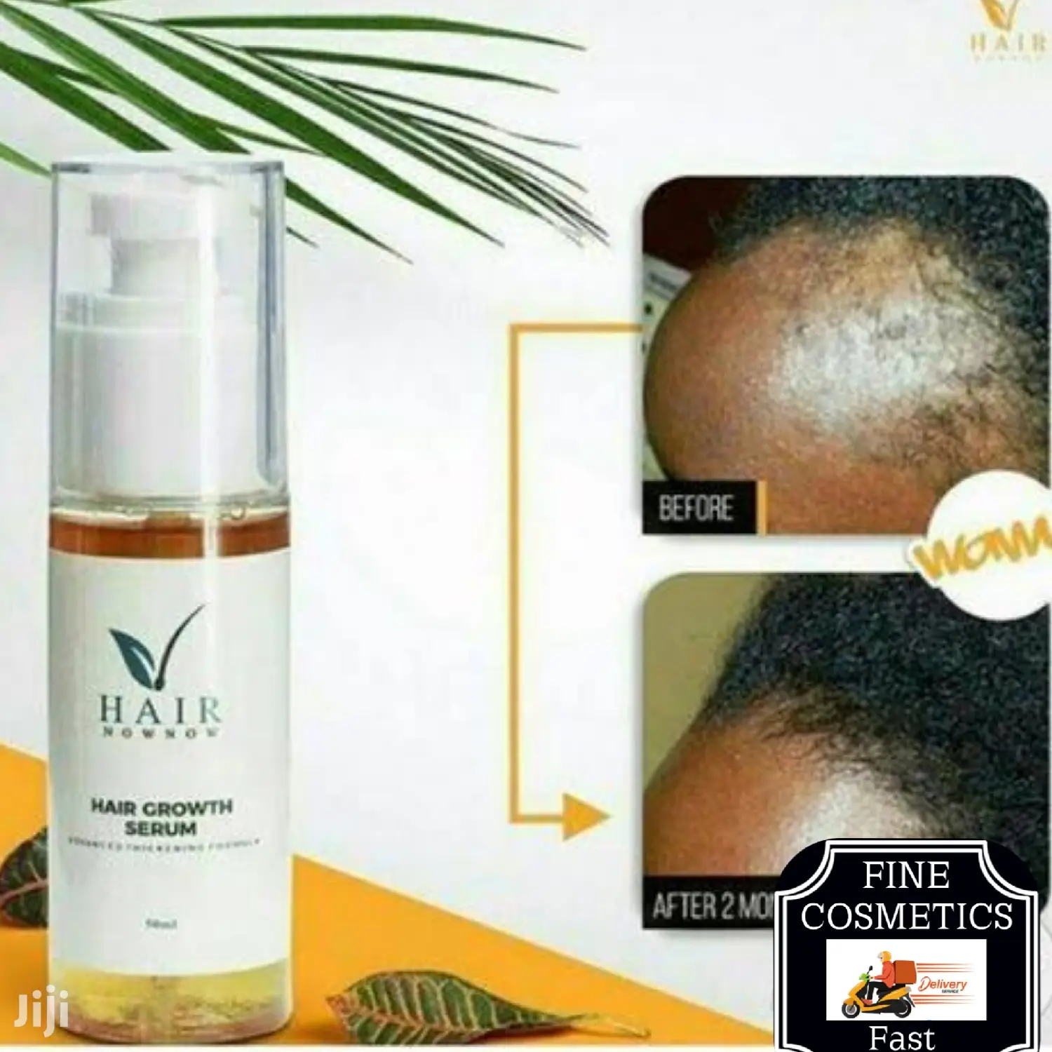 Hair Now Now | Hair Growth Booster Hairline Stimulating Oil.