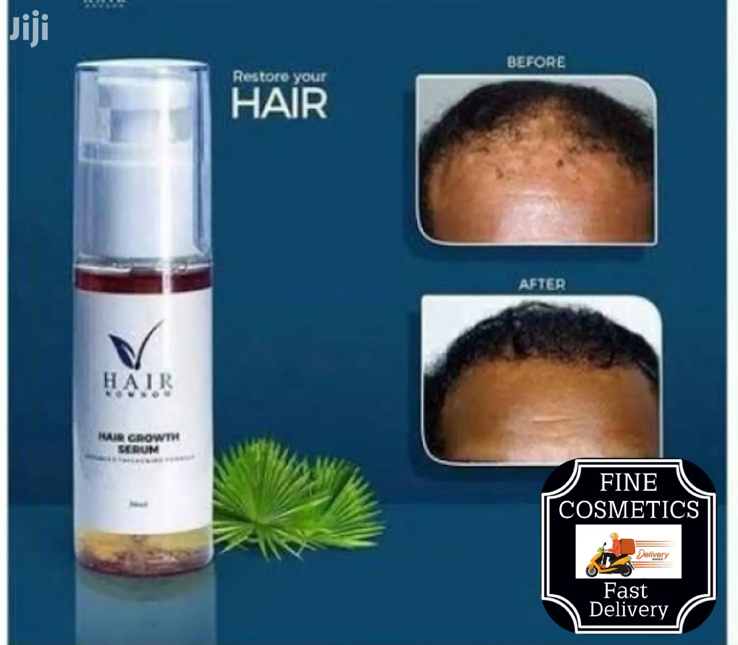 Hair Now Now | Hair Growth Booster Hairline Stimulating Oil.