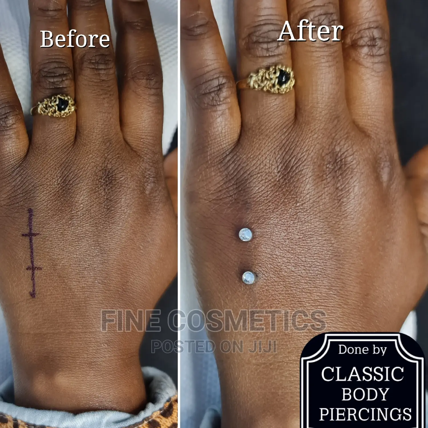 Wrist Piercing ,Hand Piercing, Finger Piercing Piercings Ug
