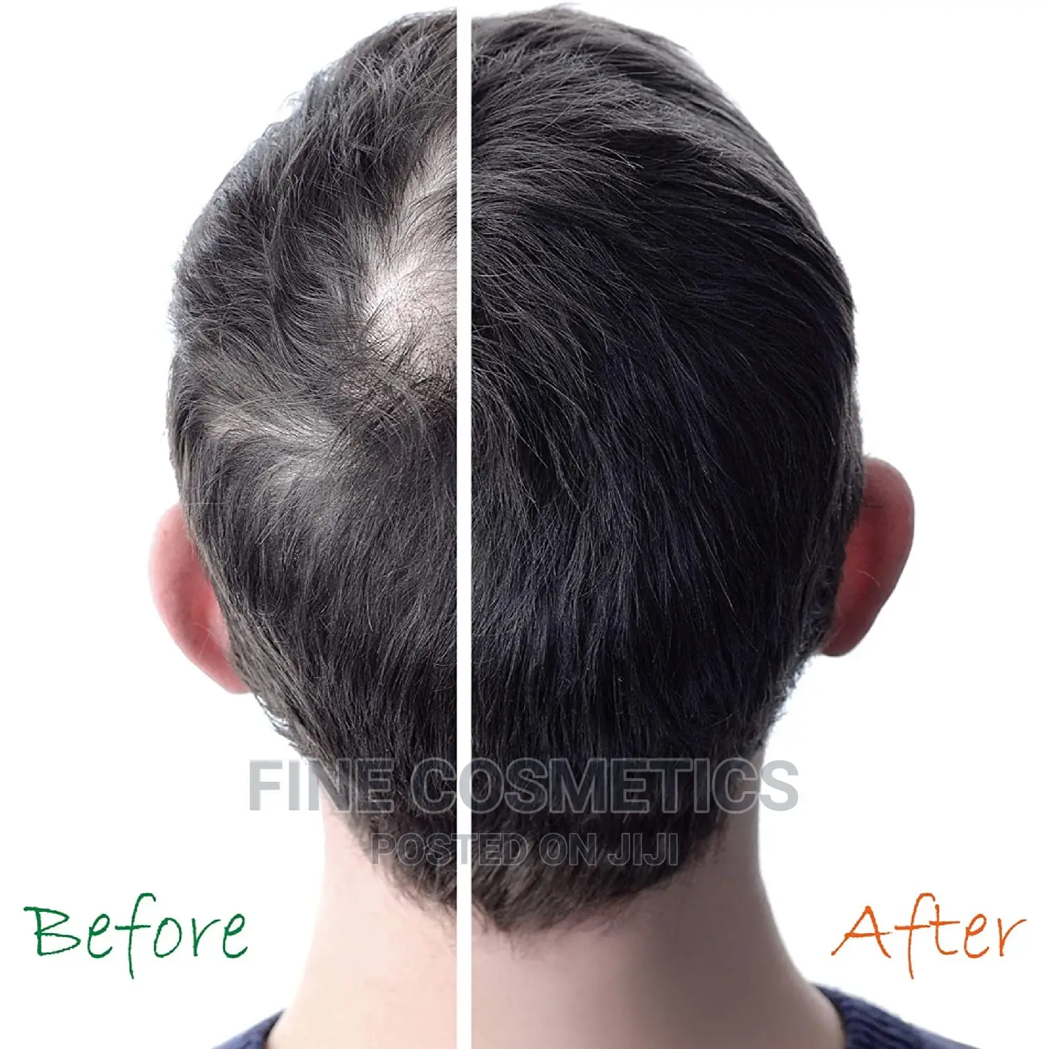Organic Hair Growth Booster With Pro Vitamin-B5 Made in USA