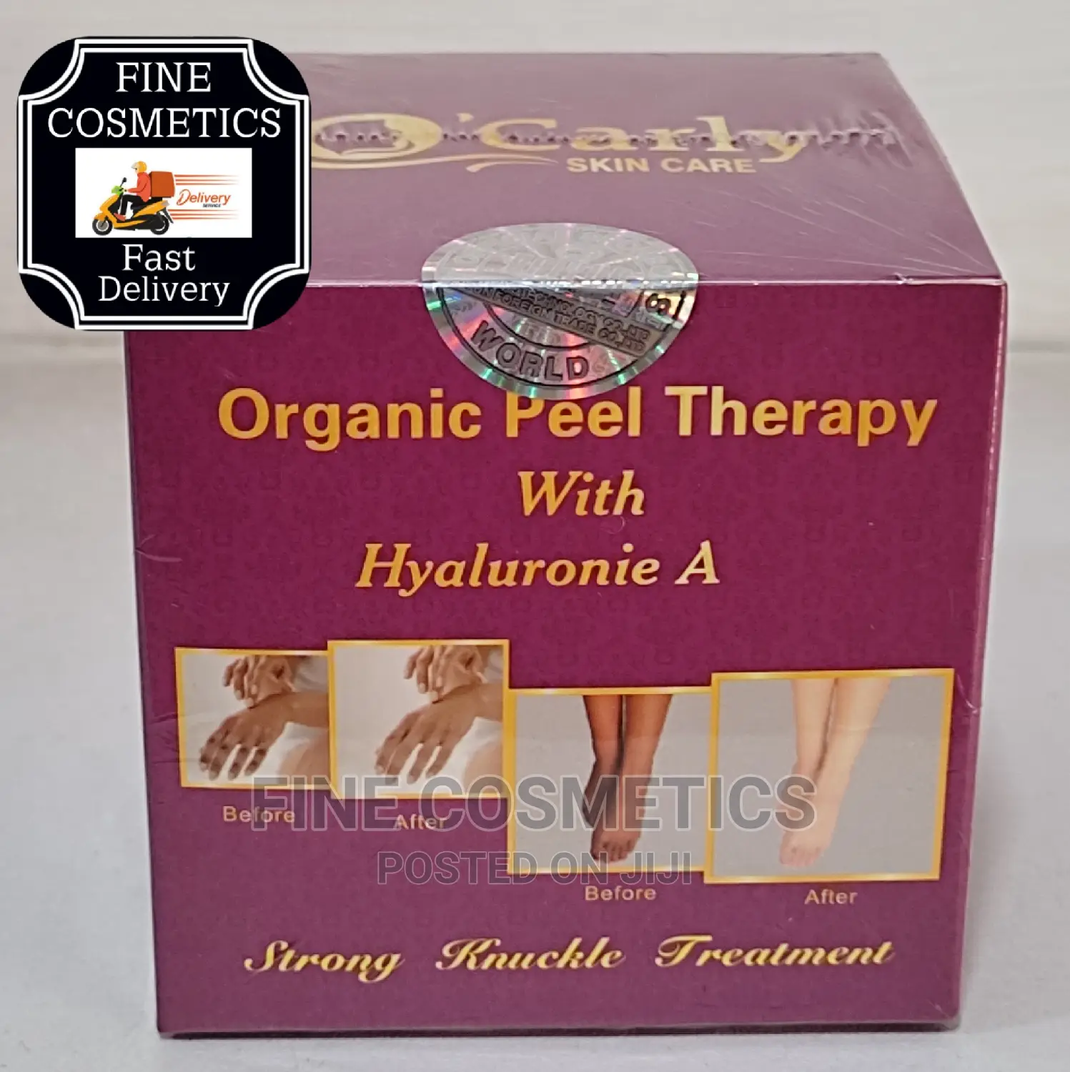 Ocarly Strong Whitening Knuckle Remover Peel Night Cream 30g