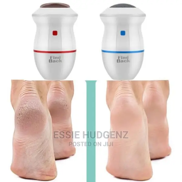 Callus Remover