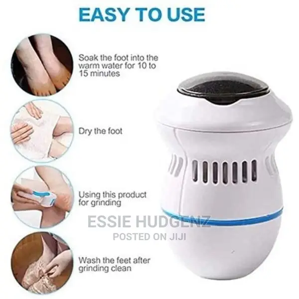 Callus Remover